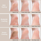 Urea Cream 40 Percent - Foot & Hand Cream for Dry, Cracked Heels, Feet, Knees, Elbows, and Hands - Maximum Strength Urea Lotion for Softening and Moisturizing