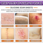 Silicone Scar Sheets, Medical Grade Silicone Scar Tape For Surgical, Hypertrophic, Keloid, C-Section, Burn, Old & New Scars, Reusable Professional Scars Removal Sheets (1.6"X 59" Roll-1.5M)