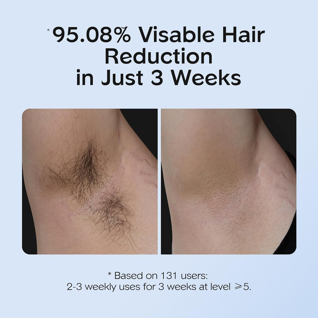 INNZA IPL Hair Removal with Ice Cooling Care Function for Women,Long-Lasting Results,999,999 Flashes Painless Hair Removal, Hair Removal Device for Armpits Legs Arms Bikini Line