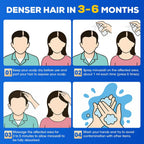 5% Minoxidil for Men and Women，Minoxidil hair growth products，Intense Hair Growth Serum，May Promote Faster, Stronger, Thicker Hair Growth to Fight Hair Loss and Thinning Hair（2.82 oz*2)