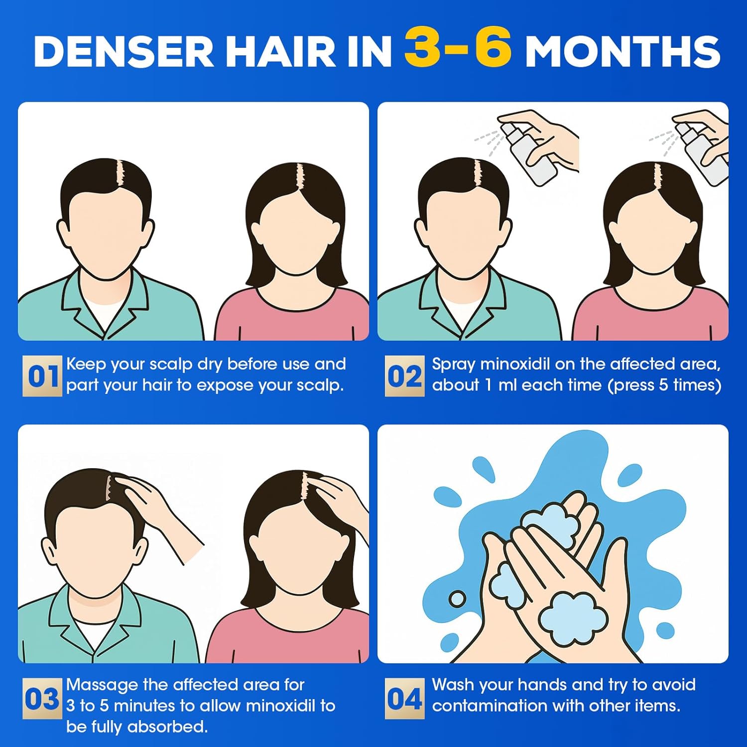 5% Minoxidil for Men and Women，Minoxidil hair growth products，Intense Hair Growth Serum，May Promote Faster, Stronger, Thicker Hair Growth to Fight Hair Loss and Thinning Hair（2.82 oz*2)