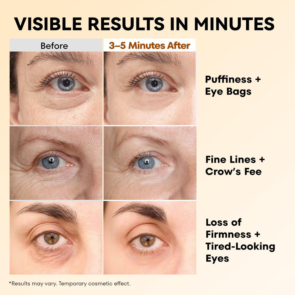 Ronkie Instant Firm Eye Tightener: Upgraded Formula For Women Helps Reduce Eye Bags Puffiness And Wrinkles In 3-5 Minutes When Time Matters 0.67 Oz