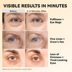 Ronkie Instant Firm Eye Tightener: Upgraded Formula For Women Helps Reduce Eye Bags Puffiness And Wrinkles In 3-5 Minutes When Time Matters 0.67 Oz