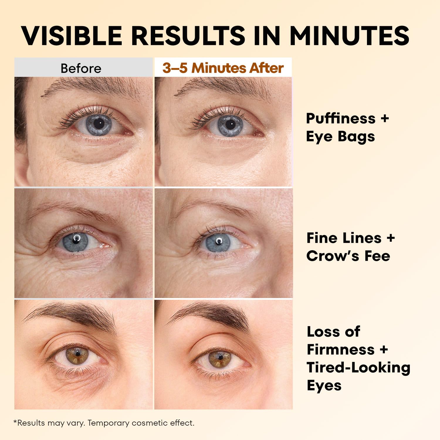 Ronkie Instant Firm Eye Tightener: Upgraded Formula For Women Helps Reduce Eye Bags Puffiness And Wrinkles In 3-5 Minutes When Time Matters 0.67 Oz