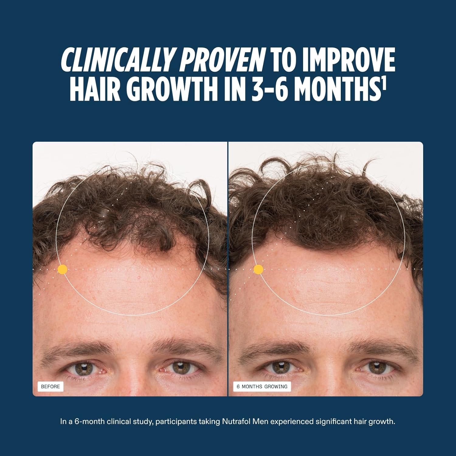 Nutrafol Men Hair Growth Supplements Ages 18-49 for Thinning Hair Clinically Tested for Visibly Thicker Hair and Scalp Coverage Dermatologist Recommended 1 Month Supply