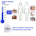 Urea Cream foot cream, 40 percent Foot Care Lotion for Cracked Heels,Moisturizing，Cracked Heels, Ultra,Rough, Dry, Calloused Feet,Softening Rough skin on feet for All Skin 5.29 fl.oz