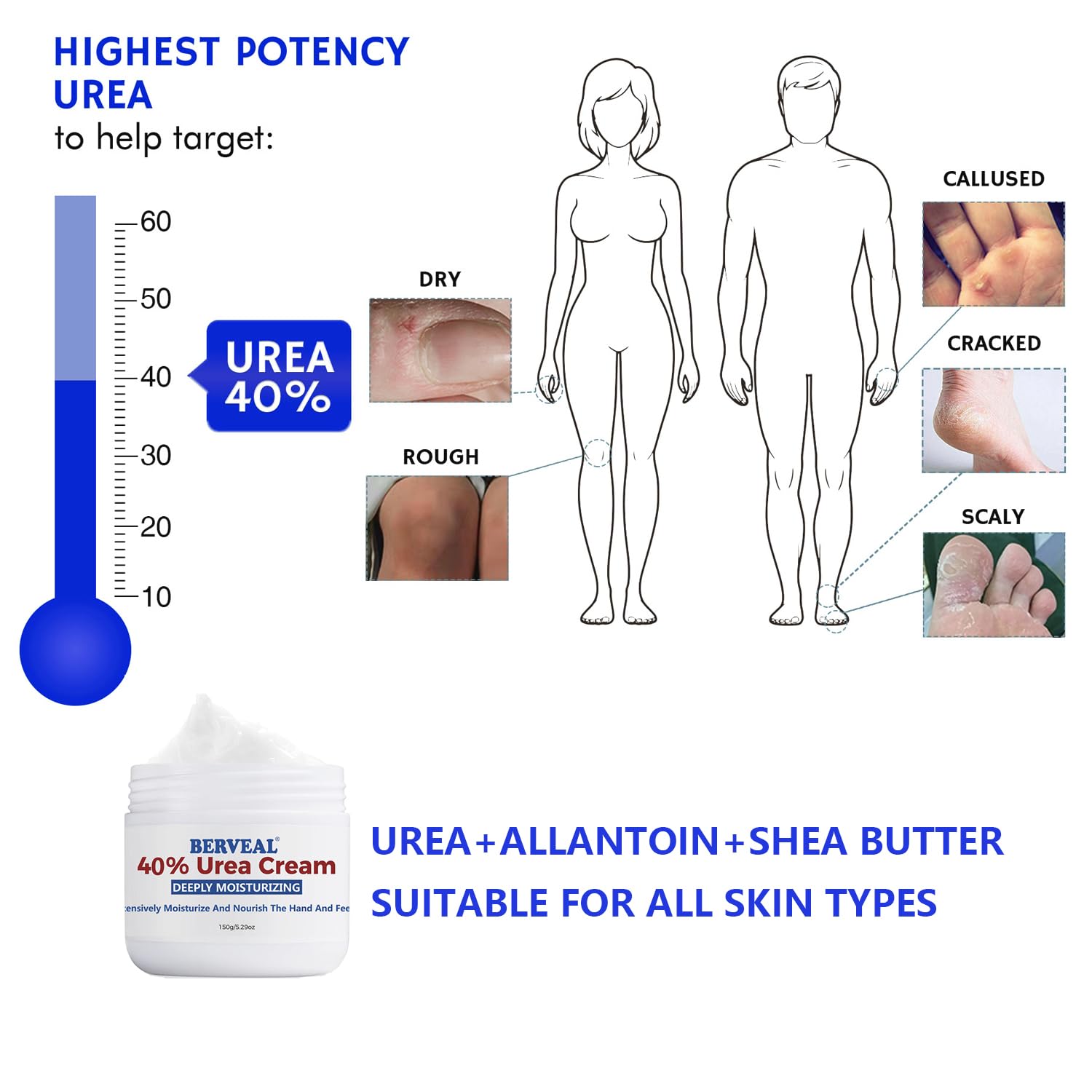 Urea Cream foot cream, 40 percent Foot Care Lotion for Cracked Heels,Moisturizing，Cracked Heels, Ultra,Rough, Dry, Calloused Feet,Softening Rough skin on feet for All Skin 5.29 fl.oz
