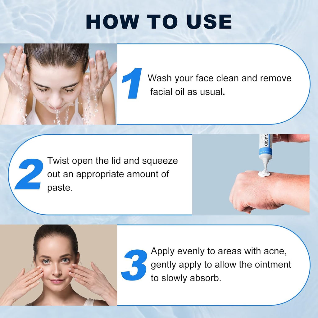 Azelaic Acid 10% Cream For Face - Acne Cream For Rosacea Reducing Relief Pimple Breakouts Blackhead Pigmentation And Redness - Azelaic Acid Gel For Facial And Skin Care