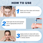 Azelaic Acid 10% Cream For Face - Acne Cream For Rosacea Reducing Relief Pimple Breakouts Blackhead Pigmentation And Redness - Azelaic Acid Gel For Facial And Skin Care