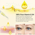 Flasture Vitamin E Oil 75,000 Iu – 100% Pure Natural Vitamin E For Skin, Face, Hair, Scars – Deep Moisturizing Body Oil For Dry Skin, Wrinkles – Cold-Pressed, Non-Gmo,Skincare – 2 Fl Oz
