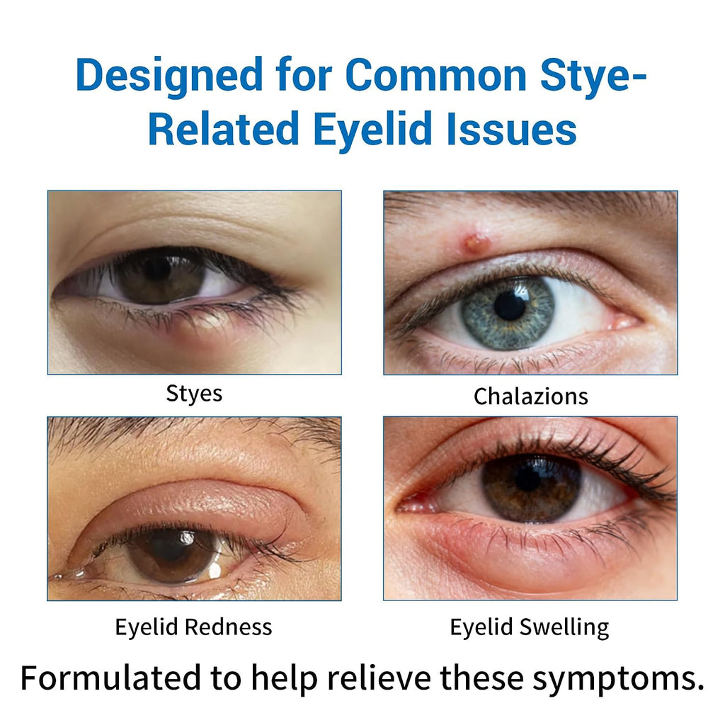 Stye Eye Treatment 2 Kits-Stye Relief Rollerball Serum & 10 Pcs Eye Patches | For Styes, Chalazions And Blepharitis Treatment For Eyelids, Stye Eye Compress, Clear Eyes Redness Relief, Sleep Eye Mask