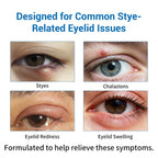 Stye Eye Treatment 2 Kits-Stye Relief Rollerball Serum & 10 Pcs Eye Patches | For Styes, Chalazions And Blepharitis Treatment For Eyelids, Stye Eye Compress, Clear Eyes Redness Relief, Sleep Eye Mask