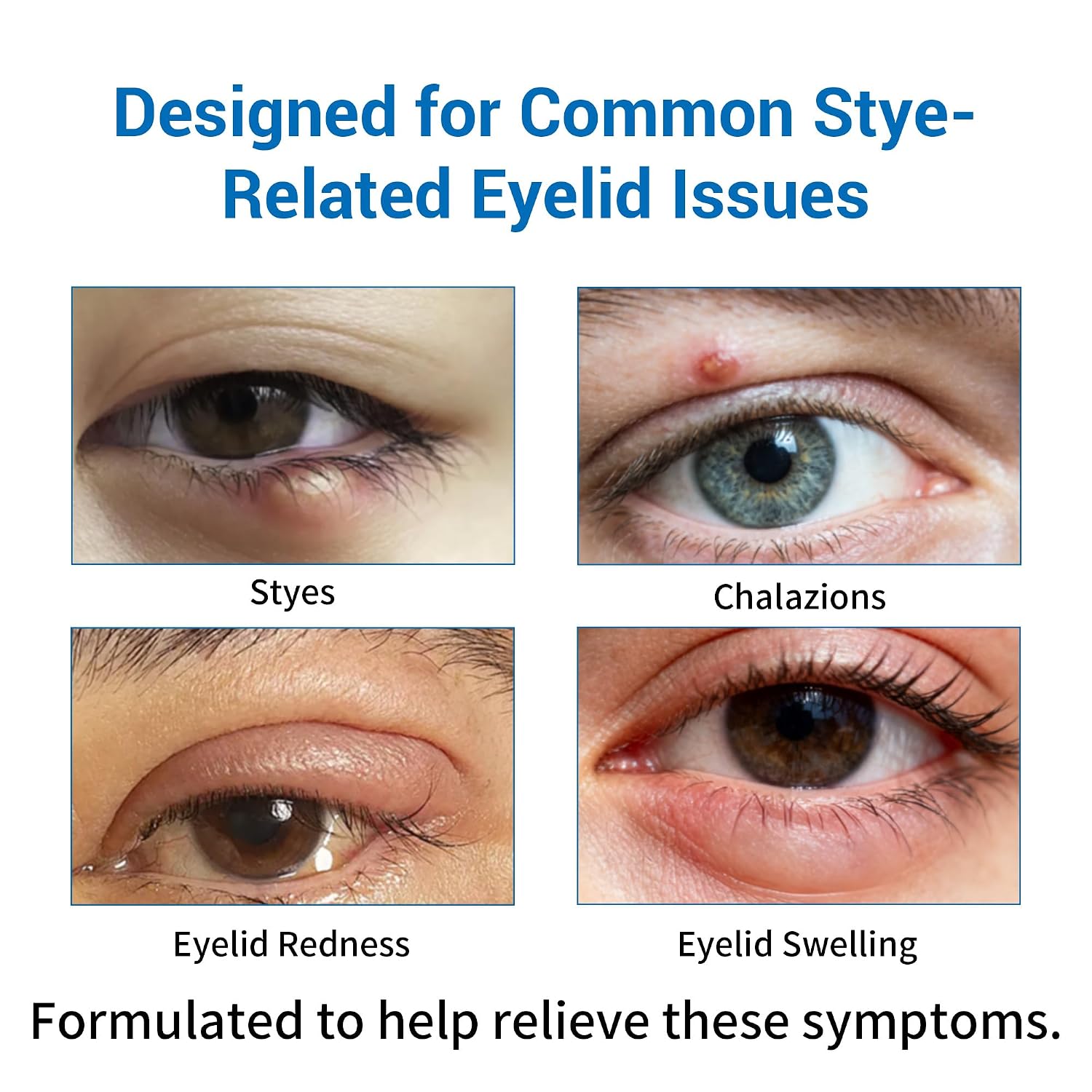 Stye Eye Treatment 2 Kits-Stye Relief Rollerball Serum & 10 Pcs Eye Patches | For Styes, Chalazions And Blepharitis Treatment For Eyelids, Stye Eye Compress, Clear Eyes Redness Relief, Sleep Eye Mask