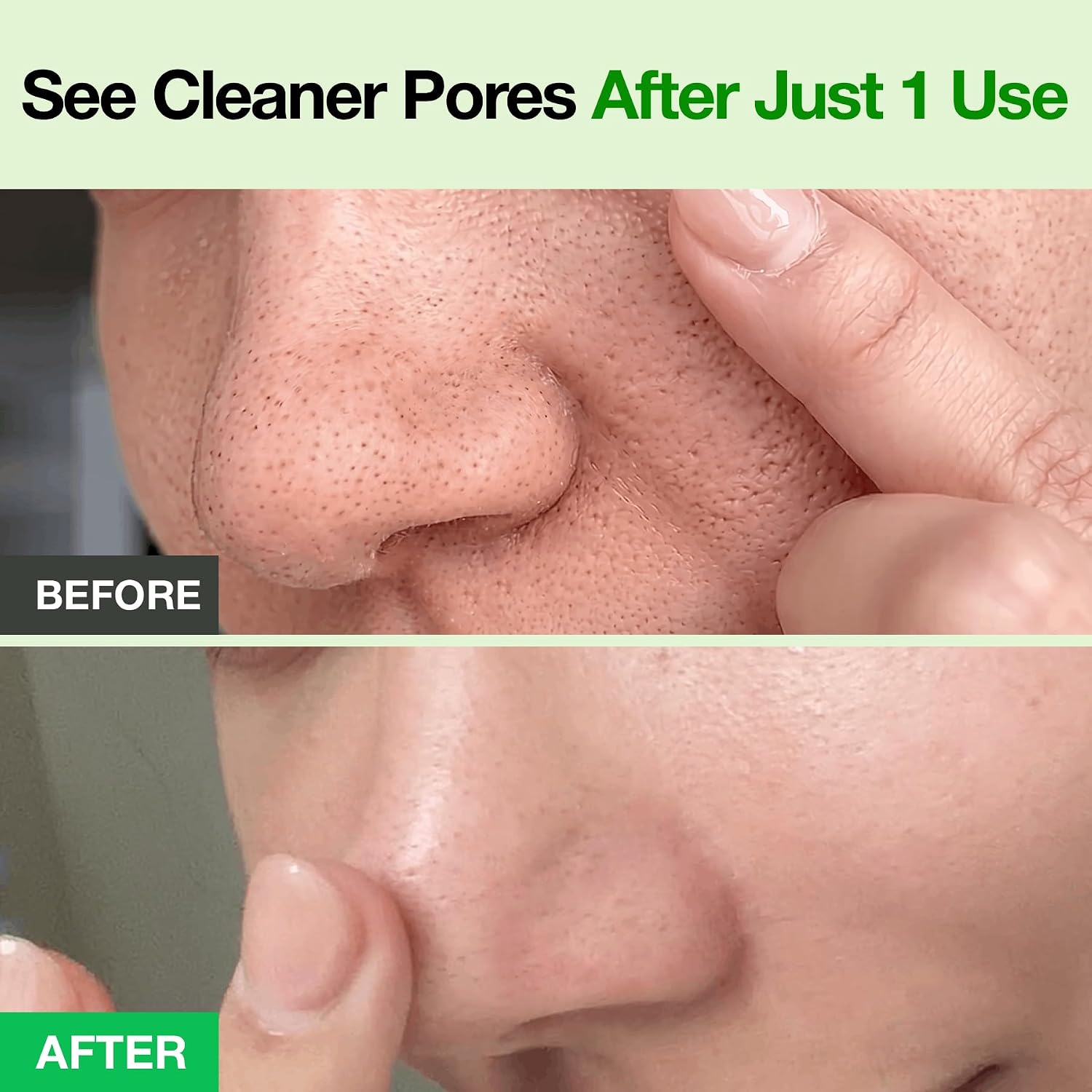 Fully Green Tomato Pore Cleanser, Cardi B’S Clay Mask Cleanser For Deep Pore Cleanse & Pore Minimizer, Blackhead & Sebum Control, Gentle Face Wash For Women, Korean Skincare