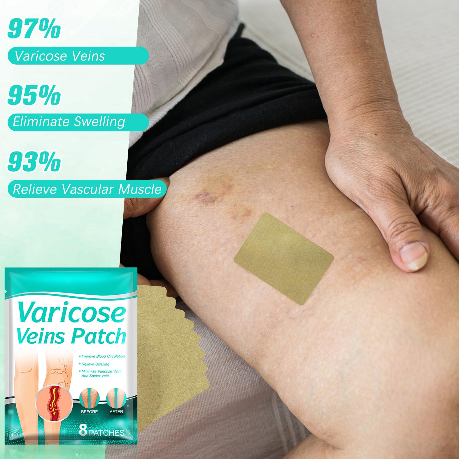 LegRenew Varicose Veins Patch,Professional Relief for Varicose Veins in The Legs，Natural Improvement Spider Veins Patch（2PCS