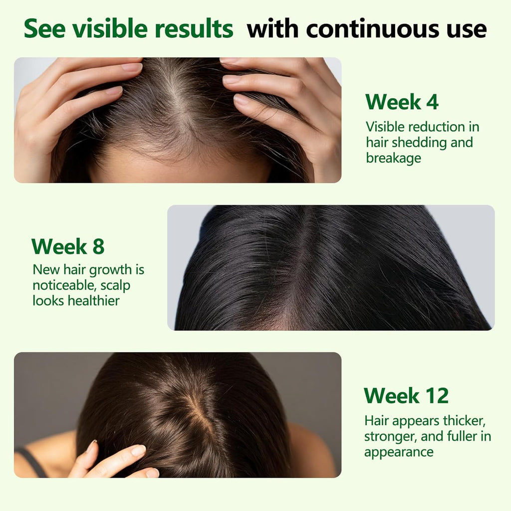 Hair Growth Serum Roll-On, Reduces Hair Shedding & Strengthens Roots, Helps Support Thicker, Fuller Hair, 3% Rosemary, 2% Ginger, 1.5% Pea Extract, 0.85 Fl Oz (Pack of 2)