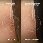 Bushbalm Ingrown Hair Exfoliating Scrub - Reduces Appearance Of Ingrown Hairs And Razor Bumps, Soothes Skin And Post-Shave Redness - Nude, 236 Ml