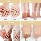 Urea Cream 50 Percent for Feet with Oat 5.29 oz || Foot & Hand Cream Maximum Strength with 2% Salicylic Acid, Tea Tree and Aloe Vera for Deep Moisturizing and Callus Removing (Upgraded Formula)