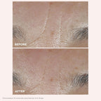 Clarins Total Eye Lift | Anti Aging Eye Cream | Targets Wrinkles, Crow'S Feet, Dark Circles And Puffiness For A Visible Eye Lift In 30 Seconds | Refillable