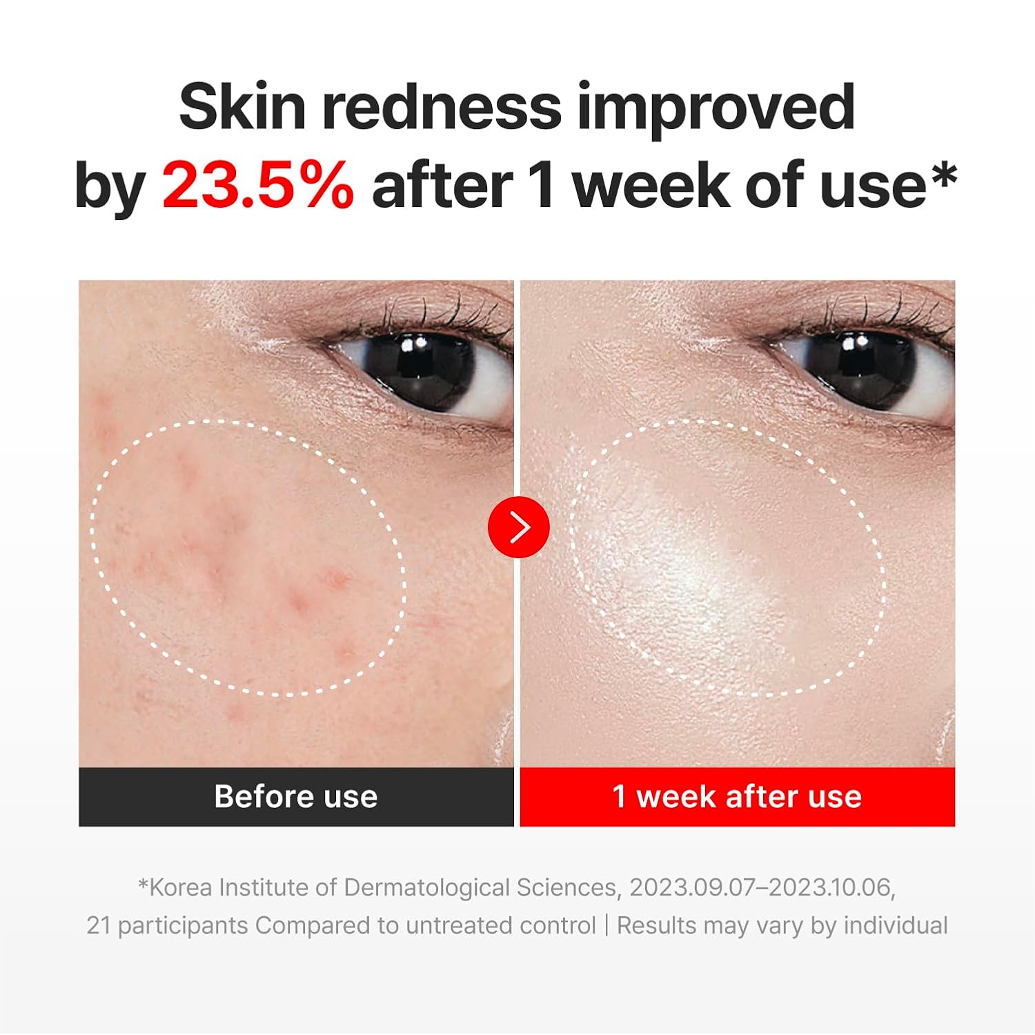 CENTELLIAN 24 Madeca Cream Time Reverse (1.69 fl oz) - TECA Centella Asiatica Glow Face Cream Moisturizer, Hydrating, Firming, Smoother Even-Looking Skin, Helps Improve Skin Elasticity,Korean Skincare