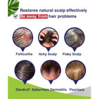 Pharmbanner Anti-Fungal Shampoo For Folliculitis, Seborrheic Dermatitis, Scalp Psoriasis - Relieves Itchy & Dry Scalp