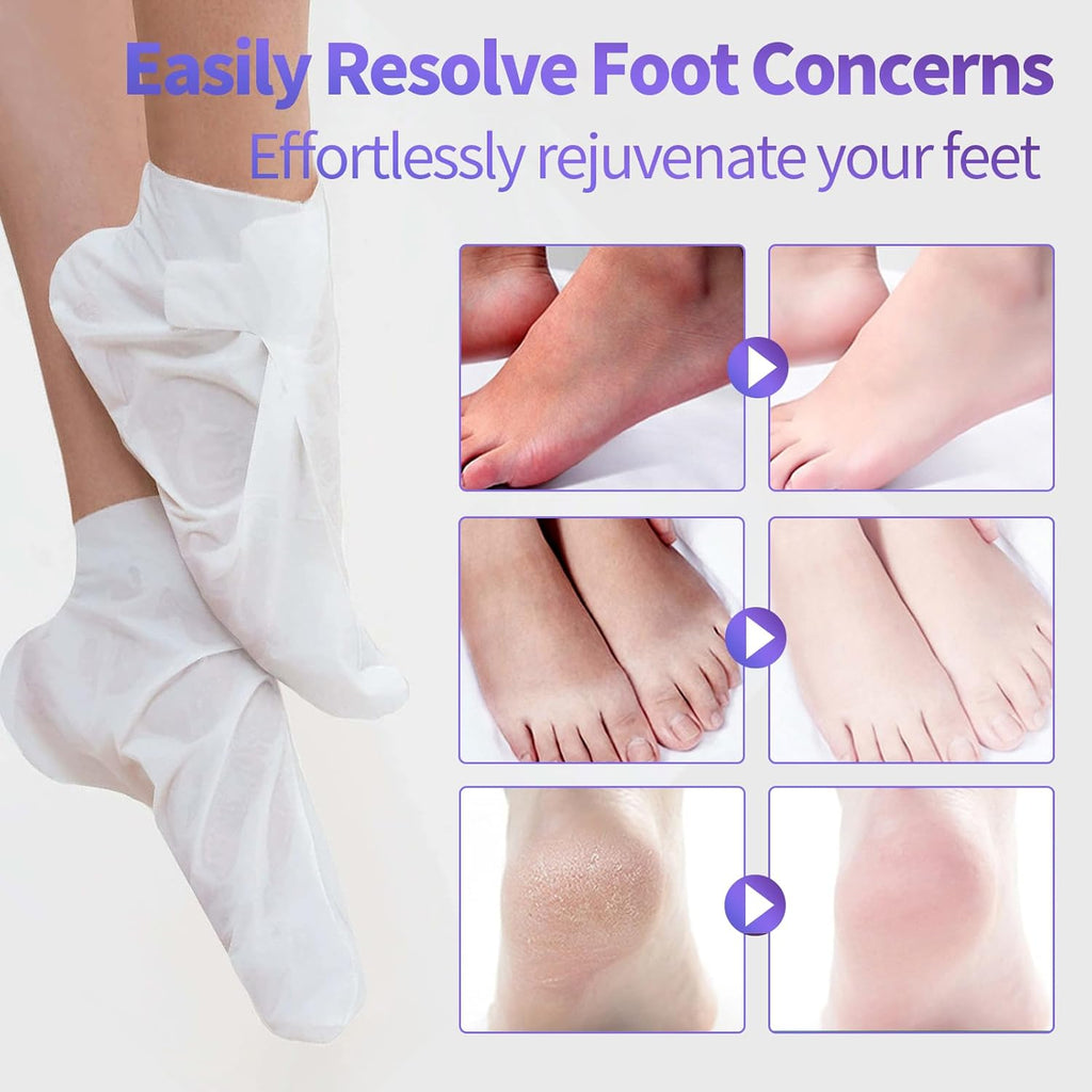 5 Pack Moisturizing Foot Mask,Hydrating Foot Masks for Dry Cracked Feet,Moisturizing Socks Dry Skin Moisturizer for Soft and Smooth Touch Feet,Foot Care Spa Gifts for Women Men Mothers Day Gifts