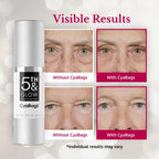 5Th & Glow Cyabags - Instant Puffy Eyes Reduction & Under Eye Bag Remover Serum For Women - Hyaluronic Acid & Vitamin C Cream For Fine Lines, Wrinkles & Crowsfeet, 1 Oz