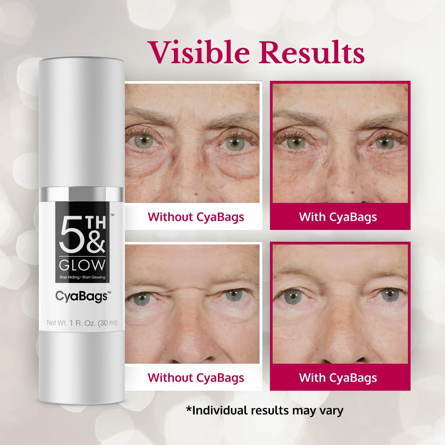 5Th & Glow Cyabags - Instant Puffy Eyes Reduction & Under Eye Bag Remover Serum For Women - Hyaluronic Acid & Vitamin C Cream For Fine Lines, Wrinkles & Crowsfeet, 1 Oz