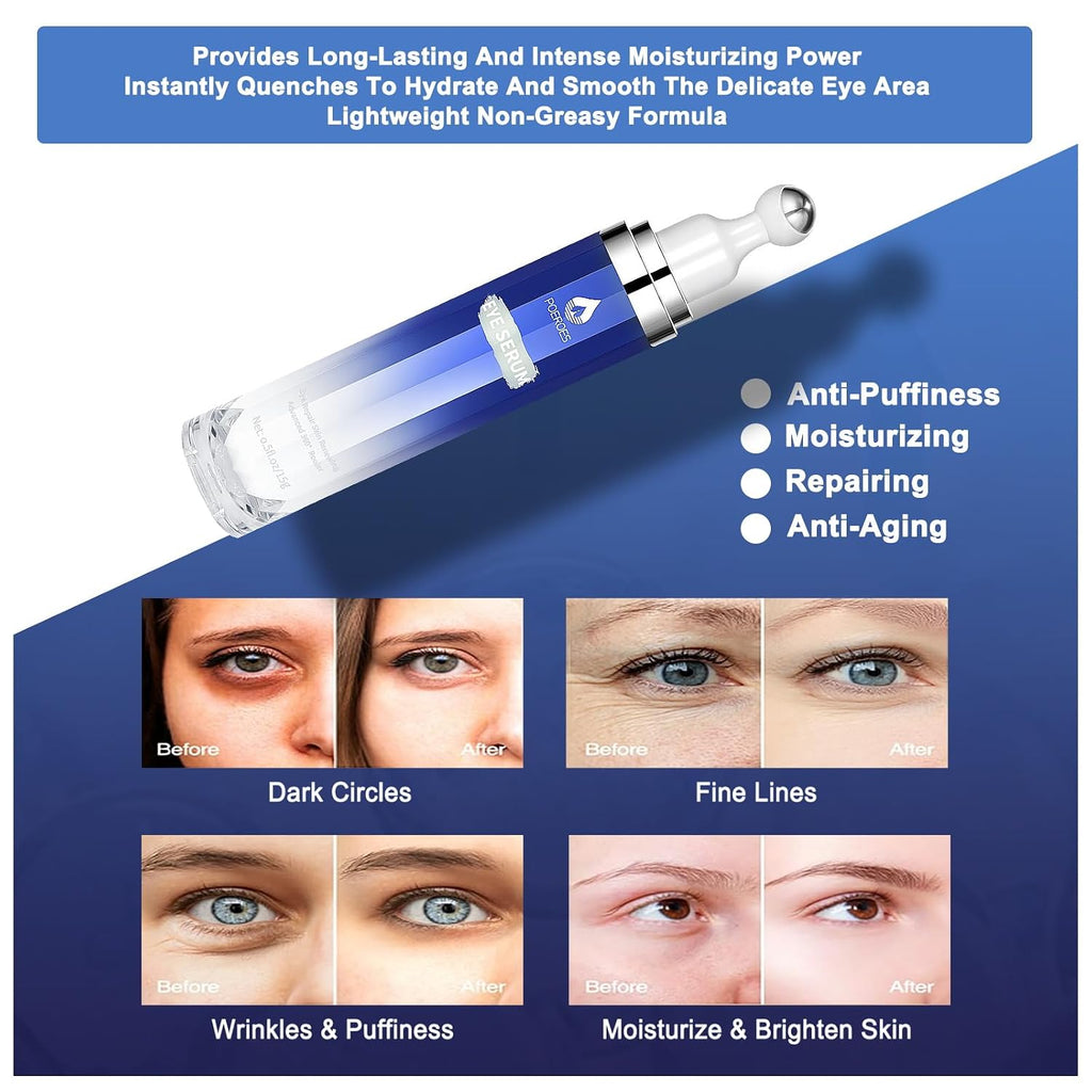 Eye Serum With 8% Caffeine & 8% Retinol, Under Eye Cream With Hyaluronic Acid, Niacinamide & Peptides, 360° Cooling Roller For Dark Circles, Puffiness, Fine Lines & Wrinkles, 0.5 Fl Oz