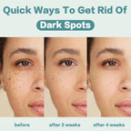 Citygoo Dark Spot Remover For Face: Dark Spot Corrector Cream - Enriching Skin Care For All Skin Tones - Melasma Freckle Sun Spot Remover & Blemish Reducer-1.7 Fl Oz
