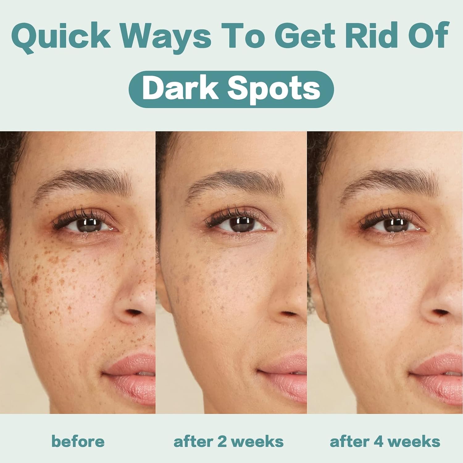 Citygoo Dark Spot Remover For Face: Dark Spot Corrector Cream - Enriching Skin Care For All Skin Tones - Melasma Freckle Sun Spot Remover & Blemish Reducer-1.7 Fl Oz