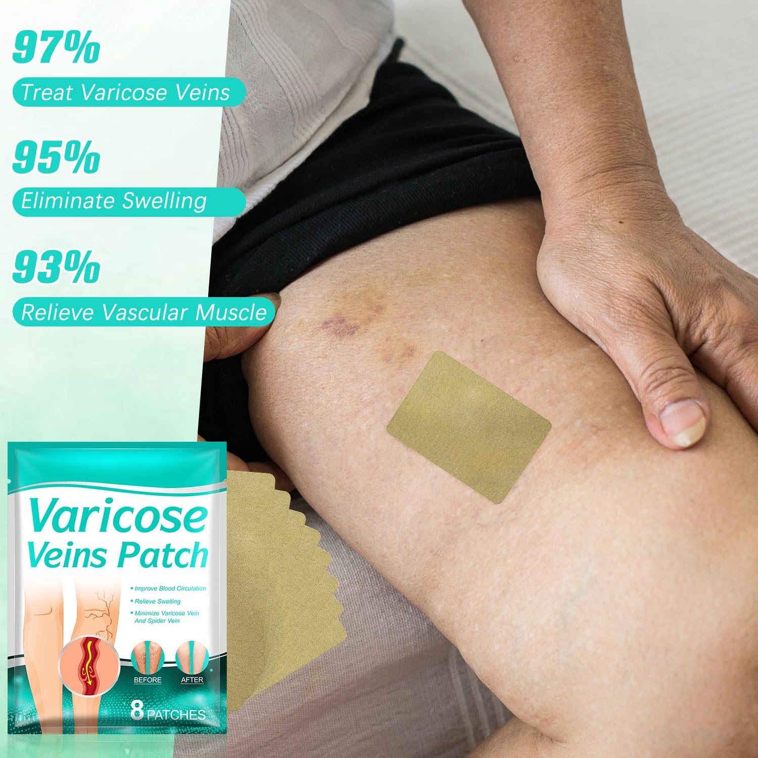 Leg Renew Varicose Veins Patch,Varicose Veins Patches Treatment For Legs,Legrenew Veins Patch,Natural Ingredients Leg Treatment For All Skin Types(16)