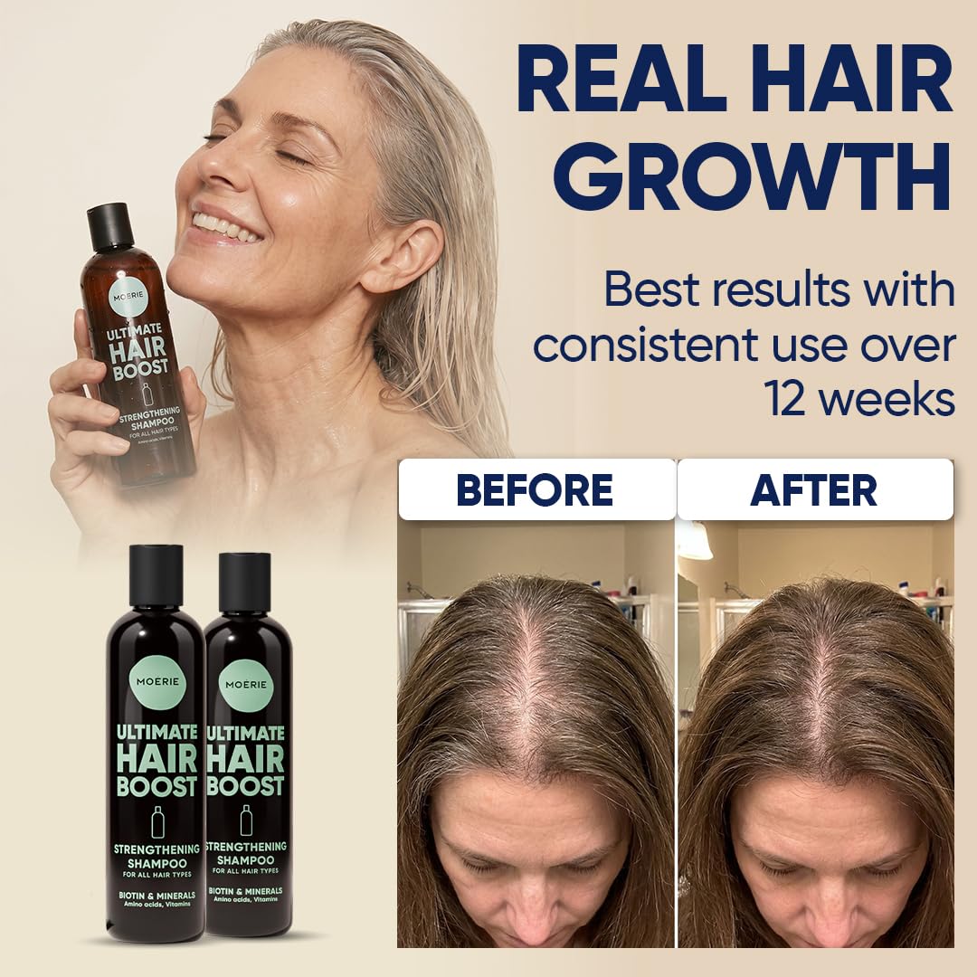 Moerie Hair Growth Shampoo For Men And Women, Hair Loss Solution With Biotin And Rosemary, Thickening Shampoo For Thinning Hair – Ultimate Boost For All Hair Types