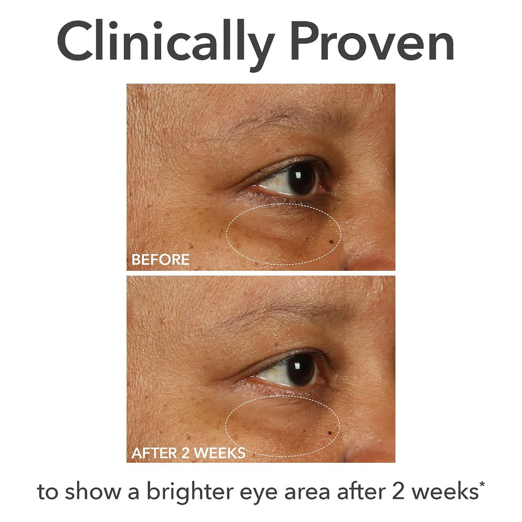 Dr Dennis Gross Derminfusions Fill + Repair Eye Cream: Hydrating & Brightening Treatment For Dark Circles, Fine Lines & Wrinkles, Firms & Smooths 360° Eye Area, 0.5 Oz