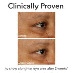 Dr Dennis Gross Derminfusions Fill + Repair Eye Cream: Hydrating & Brightening Treatment For Dark Circles, Fine Lines & Wrinkles, Firms & Smooths 360° Eye Area, 0.5 Oz