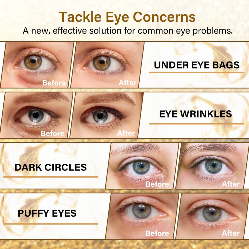 Gold Cucumber Under Eye Patches - 60 Pcs Hydrogel Eye Mask For Dark Circles & Wrinkles, With Collagen, Hyaluronic Acid & Castor Oil - Hydrating & Smoothing Treatment Gift Set For Men & Women