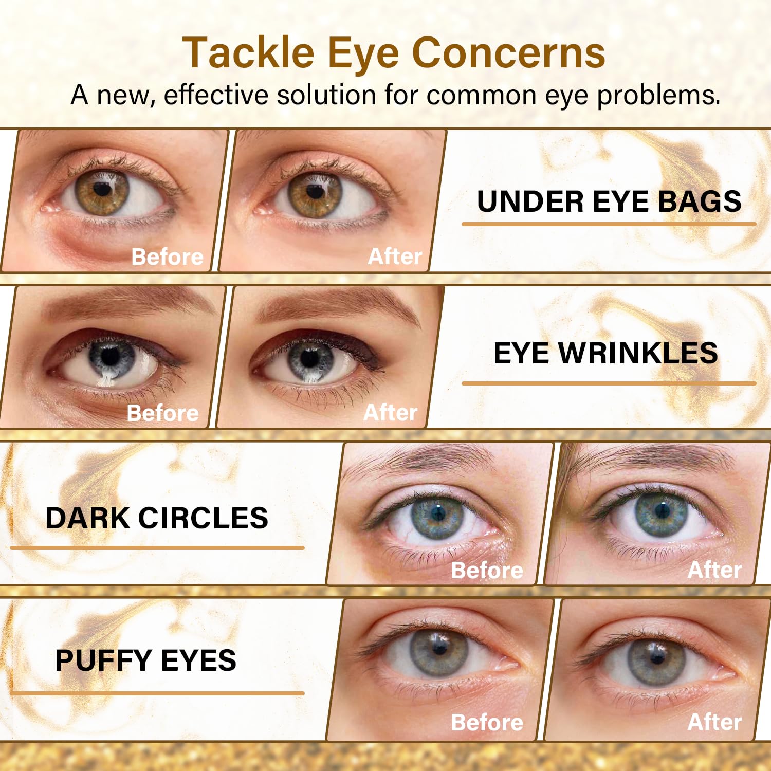 Gold Cucumber Under Eye Patches - 60 Pcs Hydrogel Eye Mask For Dark Circles & Wrinkles, With Collagen, Hyaluronic Acid & Castor Oil - Hydrating & Smoothing Treatment Gift Set For Men & Women