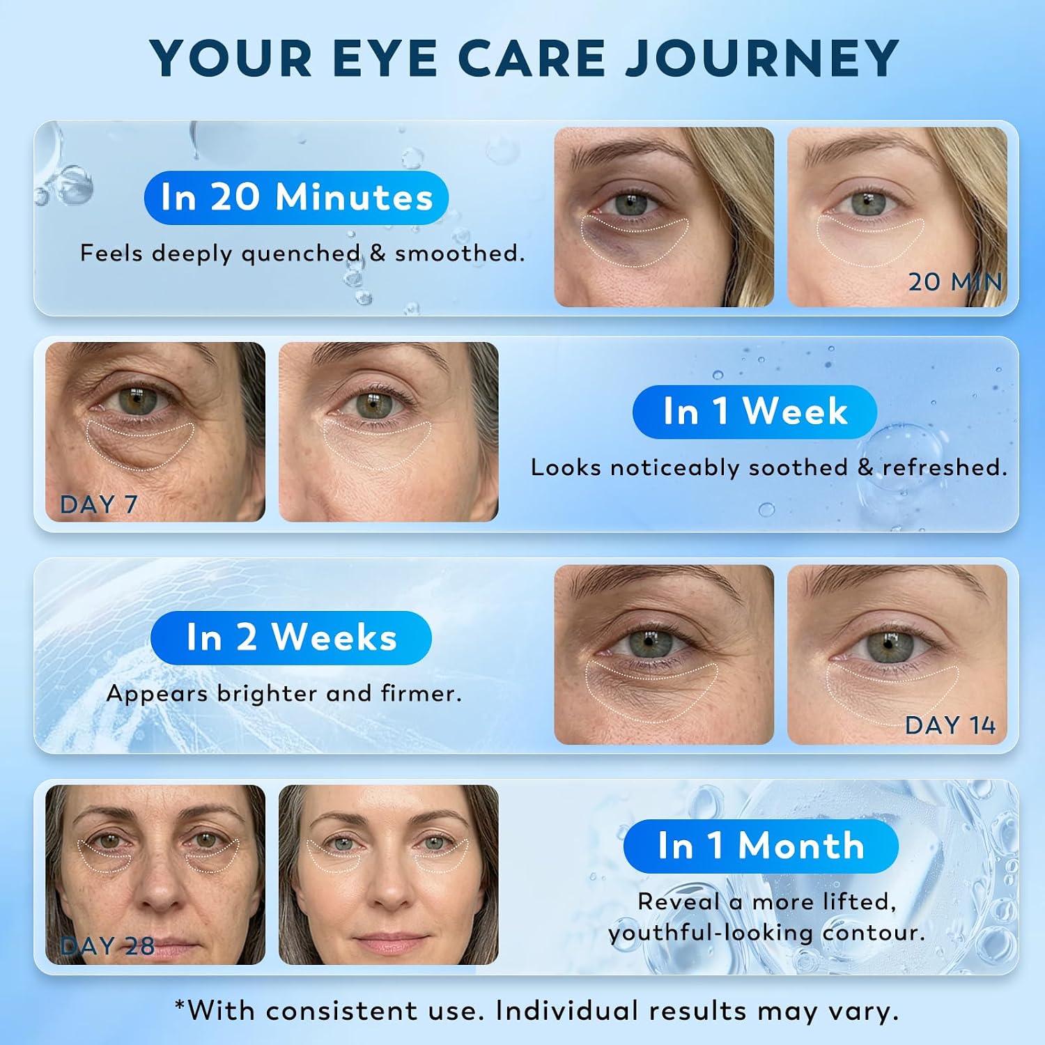 Retinol Collagen Under Eye Patches For Men & Women 30 Pairs | Hydrogel Eye Masks For Dark Circles, Wrinkles & Firming - Hydrating Anti-Aging Gel Pads