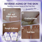 LANBENA Lavender Foot Peel Mask - Foot Peeling Mask for Removing Dry Dead Skin, Calluses & Repairing Rough Heels, for Baby Soft, Smooth Feet - (Lavender - 2 Pairs)