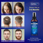 5% Minoxidil for Women and Men: 2-Pack Minoxidil Hair Growth Products - Minoxidil for Men - Biotin Serum - Hair Growth Serum with Rosemary - Hair Loss Solution - Faster Stronger Thicker - 60ML Each