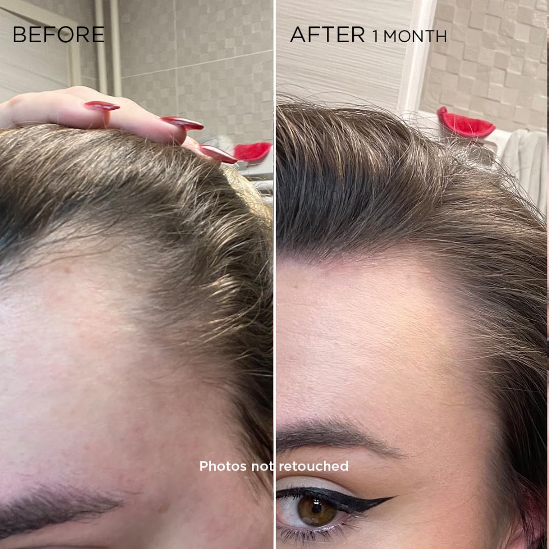 PHYTOCYANE WOMEN TREATMENT REACTIONAL HAIR THINNING