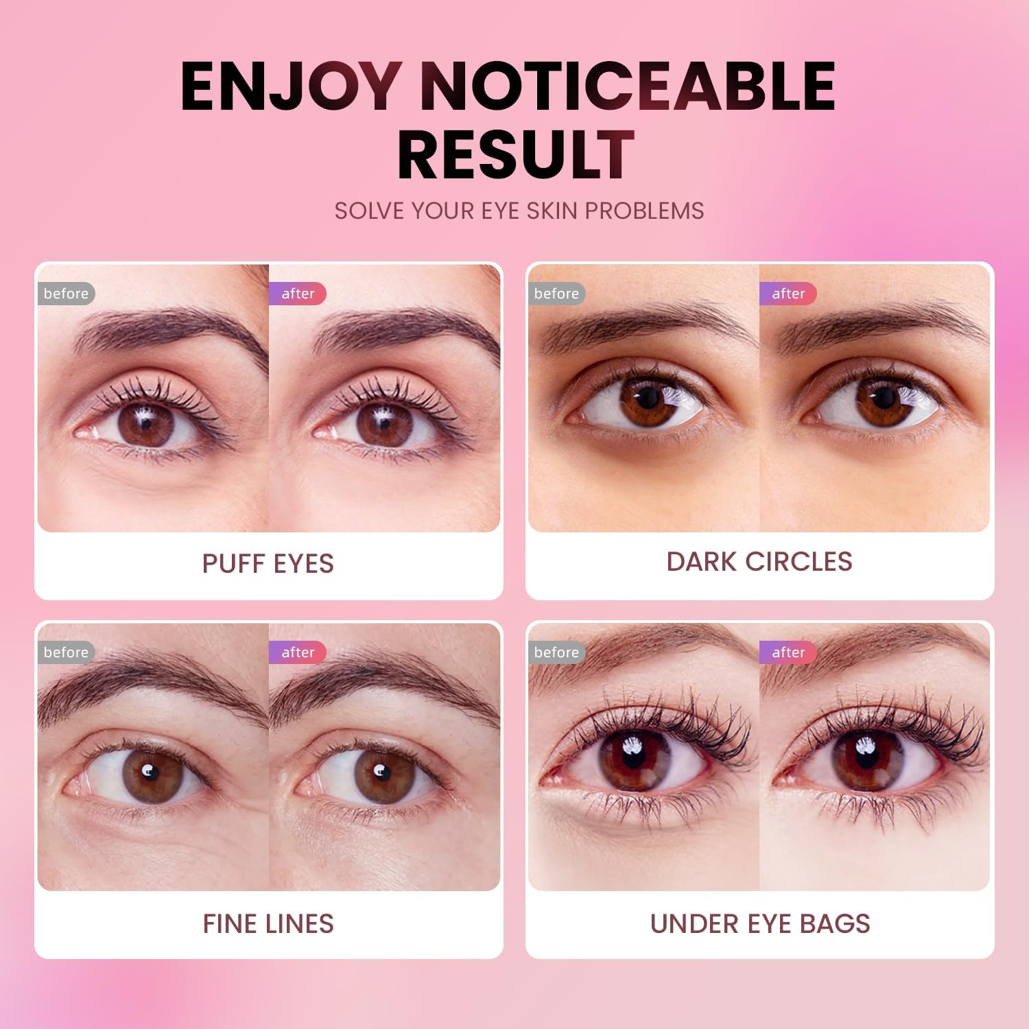 Under Eye Patches (24 Pairs) - Tri-Color Glitter Eye Gel Pads For Dark Circles, Puffy Eyes, Under Eye Bags, Wrinkles | Natural Collagen Under Eye Mask Patches, Gel Under Eye Patches