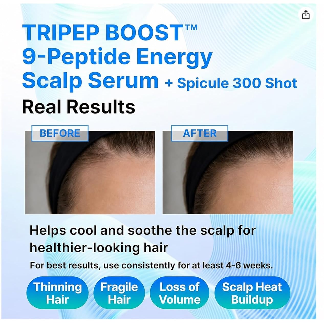 9-Peptide Hair Growth Scalp Care Serum 1.35 Oz(2X Size) - Rosemary 2% Caffeine 1% Pdrn & Spicule 300 Roll-On Type | Thicker Fuller-Looking Hair W/Niacinamide Zinc Pca | Thinning Hair Korean Haircare
