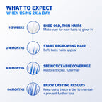 Men’s Rogaine Extra Strength 5% Minoxidil, Topical Solution for Thinning & Hair Loss, Clinically Proven FDA Approved Minoxidil for Men Treatment, Regrow Fuller Hair, 3 Month Supply, 3 Bottles