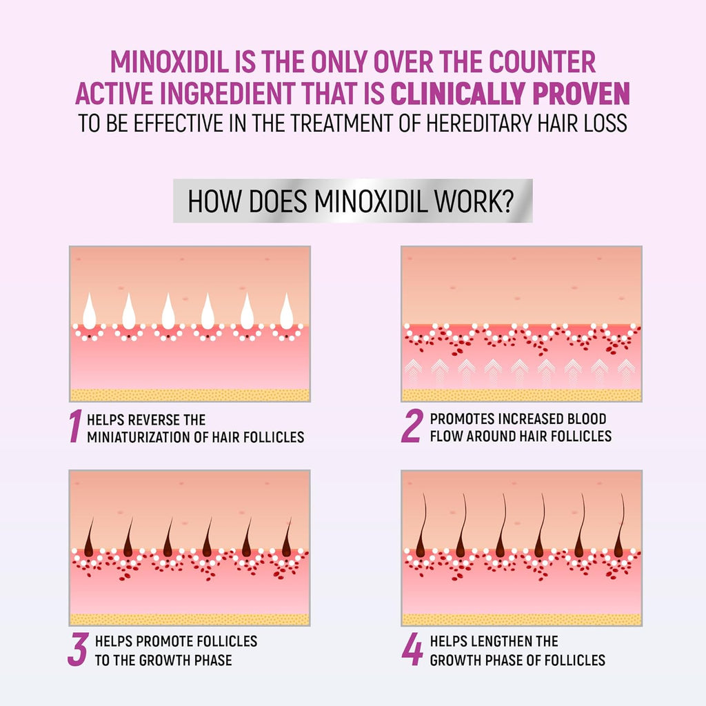 Minoxidil for Women, 2.11 Oz (2 Months Supply) Clinically Proven to Regrow Hair, Topical Aerosol Foam 5%, Hair Thinning Treatment