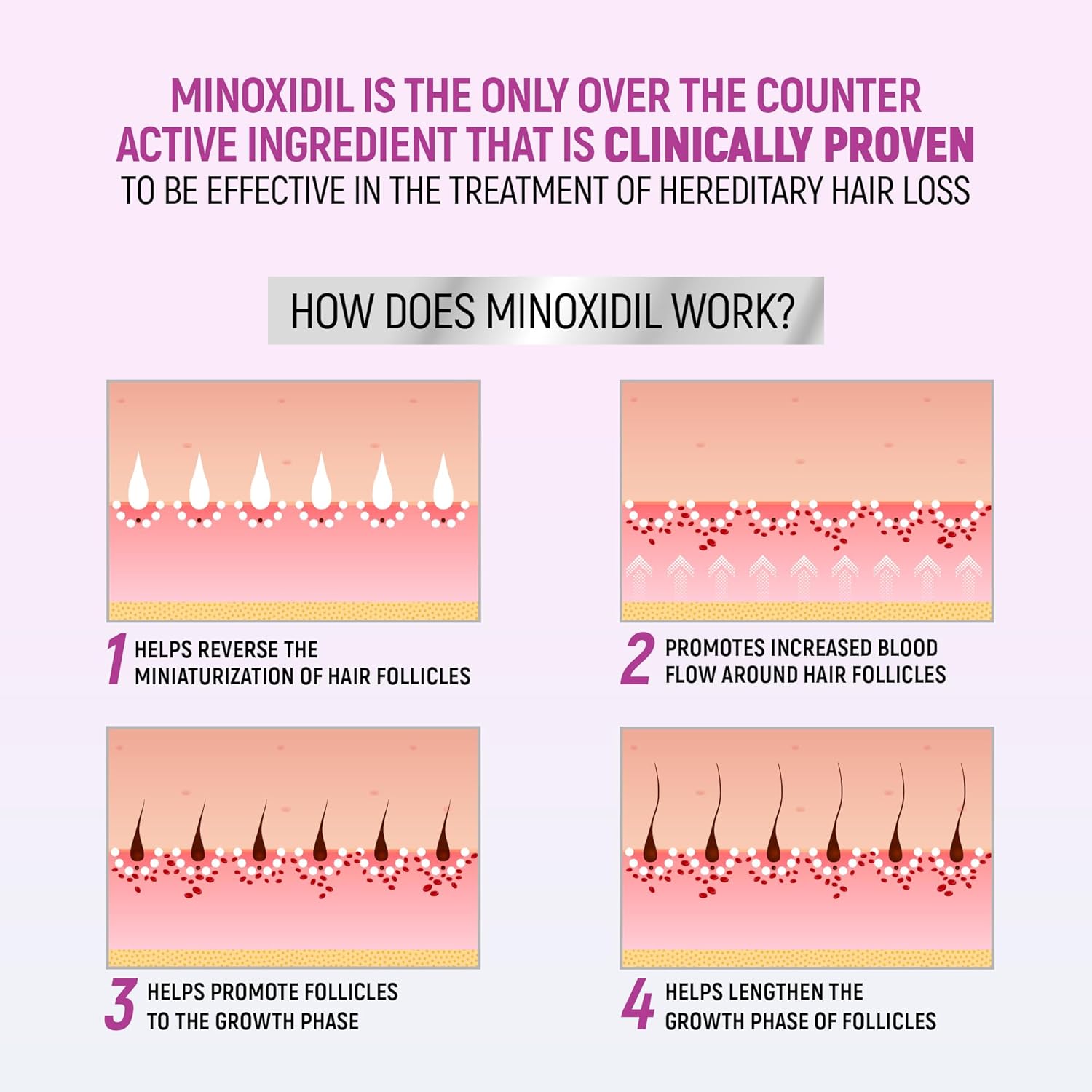 Minoxidil for Women, 2.11 Oz (2 Months Supply) Clinically Proven to Regrow Hair, Topical Aerosol Foam 5%, Hair Thinning Treatment