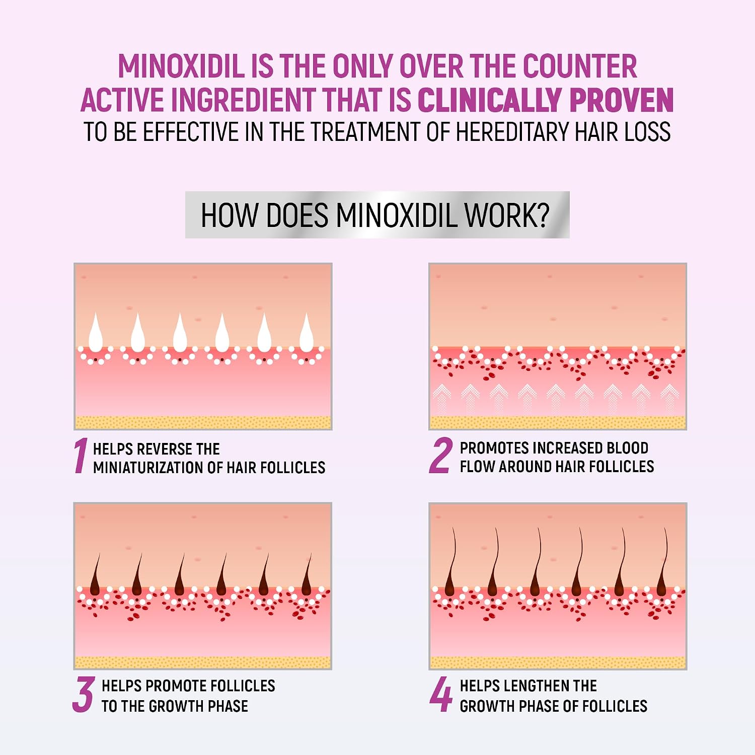 Minoxidil For Women, 2.11 Oz (2 Months Supply) Clinically Proven To Regrow Hair, Topical Aerosol Foam 5%, Hair Thinning Treatment