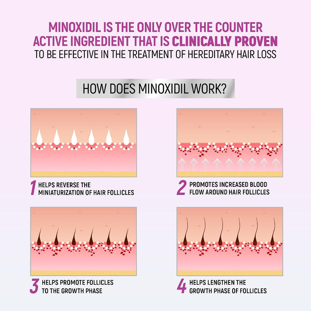 Minoxidil For Women, 2.11 Oz (2 Months Supply) Clinically Proven To Regrow Hair, Topical Aerosol Foam 5%, Hair Thinning Treatment