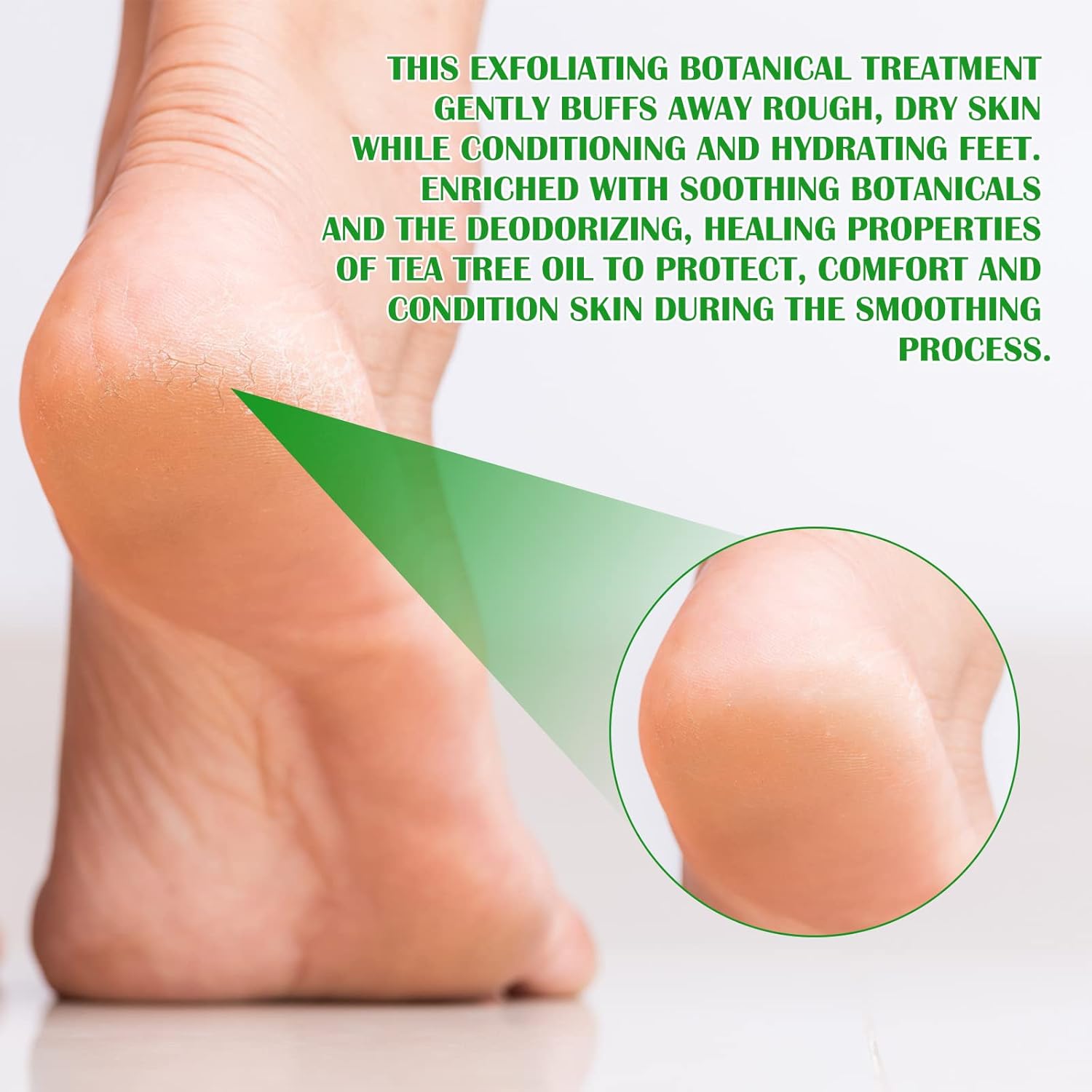 Green Tea Hydrating Foot Peel Spray - Removes Dead Skin in Seconds
