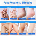 Sagry Urea Cream 40 Percent for Feet Maximum Strength, Foot Cream for Dry Cracked Heels Feet Knees Elbows Hands, Urea 40% Cream for Deep Moisturizes, Callus Remover, Heel Crack Repair